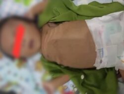 Muhamad Rasyib Abdilah Mengalami Gizi Buruk Usia 2 Bulan Rujuk Dari RSBC Mesuji Ke Rs Mitra Mulya Husada Bandar Lampung